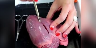 (ویدئو) قلب انسان هوش مستقل دارد!/ کالبد‌شکافی جالب قلب را ببینید