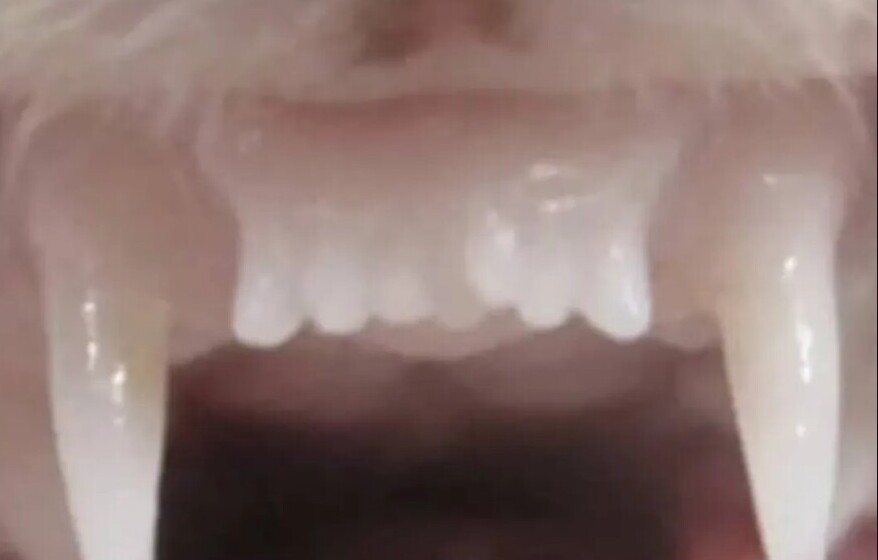 دندان راسو