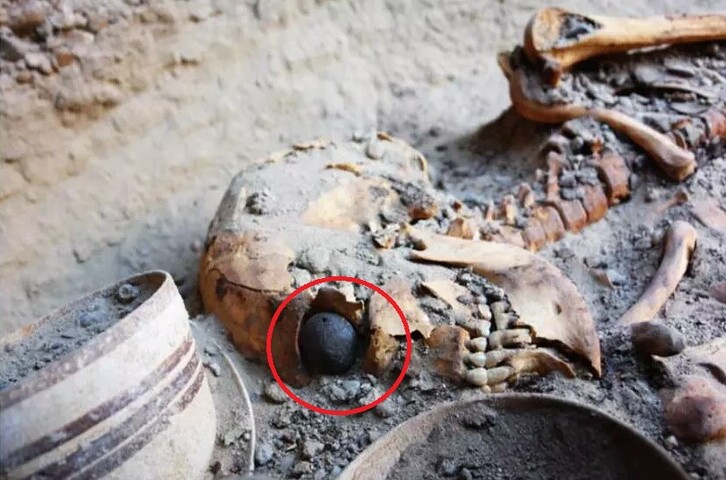 ویدیو/ کشف چشم مصنوعی با قدمت 5000 ساله در گورستان شهر سوخته