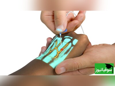 ویدیو/ عملکرد بی‌نظیر دستگاه رگ‌یاب لیزری/ احتمالاً دیگه نباید نگران داغون شدن رگ موقع خون‌گیری باشیم
