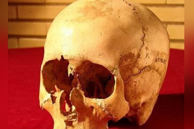 (تصاویر) کشف جمجمه 6000 ساله با شواهد حیرت‌انگیز از جراحی گوش؛ رازهای پنهان تاریخ پزشکی که تصورات ما را به چالش می‌کشد