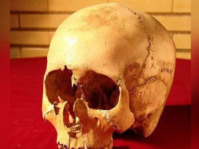 (تصاویر) کشف جمجمه 6000 ساله با شواهد حیرت‌انگیز از جراحی گوش؛ رازهای پنهان تاریخ پزشکی که تصورات ما را به چالش می‌کشد