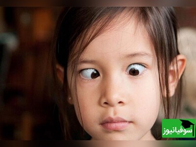 ویدئو/ آیا تقویت چشم با ورزش‌های چشمی امکان‌پذیر است؟
