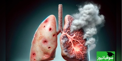 (ویدیو) سیگار چگونه عمر را کوتاه می‌کند؟/مضرات مرگ‌آور دخانیات از ریه تا قلب در معرض خطر