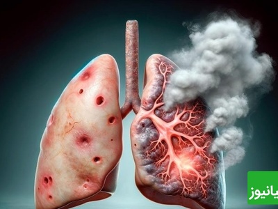 (ویدیو) سیگار چگونه عمر را کوتاه می‌کند؟/مضرات مرگ‌آور دخانیات از ریه تا قلب در معرض خطر