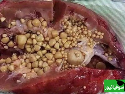 ویدیو/ یکی از لحظات سنگ‌ساز کلیه، عرق کردن در زیر آفتاب است...