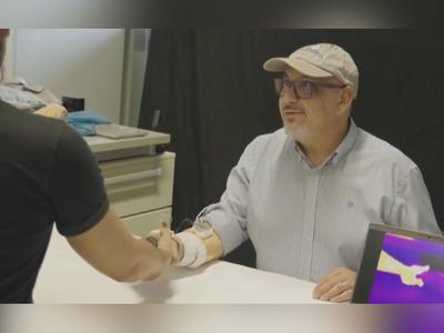 (فیلم) معجزۀ شگفت‌انگیز تکنولوژی برای افراد قطع عضو