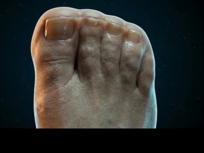 ببینید| اگر انگشتان پایتان به هم چسبیده بودند، چه بلایی سر راه رفتنتان می‌آمد؟