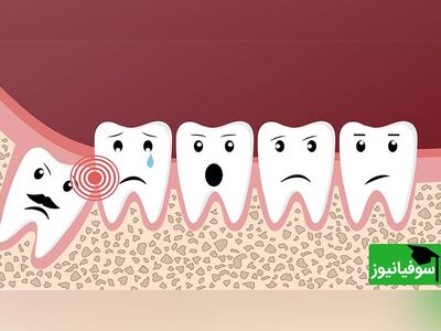 (ویدئو) چرا باید دندان عقل را کشید؟/ کیا هنوز دندون عقلشون مونده این کلیپ رو حتماً ببینن