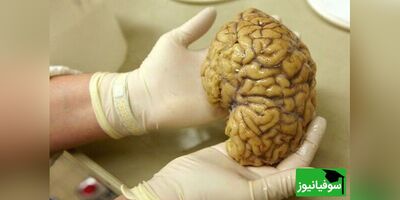 (ویدئو) حجم مغز متولدین دهۀ 1970 بزرگتر از مغز متولدین دهۀ 1930