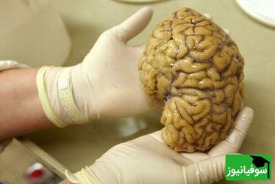 (ویدئو) حجم مغز متولدین دهۀ 1970 بزرگتر از مغز متولدین دهۀ 1930