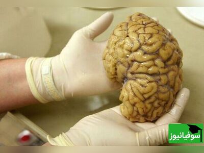 (ویدئو) حجم مغز متولدین دهۀ 1970 بزرگتر از مغز متولدین دهۀ 1930