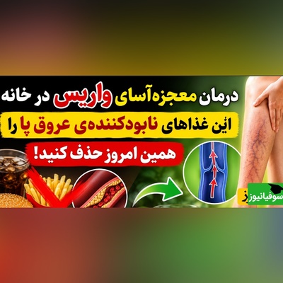 (ویدئو) درمان واریس با بشقاب غذا؛ روش‌های خانگی طب سنتی برای رهایی از رگ‌های برجسته پا