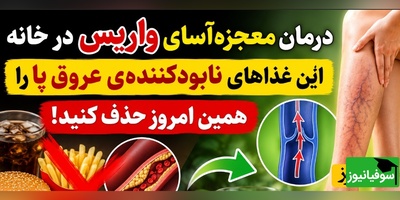 (ویدئو) درمان واریس با بشقاب غذا؛ روش‌های خانگی طب سنتی برای رهایی از رگ‌های برجسته پا