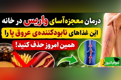 (ویدئو) درمان واریس با بشقاب غذا؛ روش‌های خانگی طب سنتی برای رهایی از رگ‌های برجسته پا