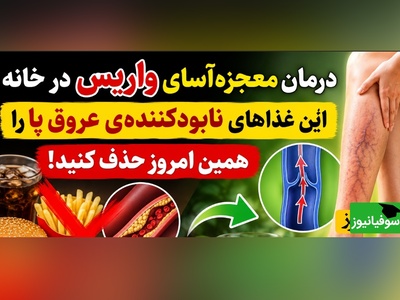 (ویدئو) درمان واریس با بشقاب غذا؛ روش‌های خانگی طب سنتی برای رهایی از رگ‌های برجسته پا