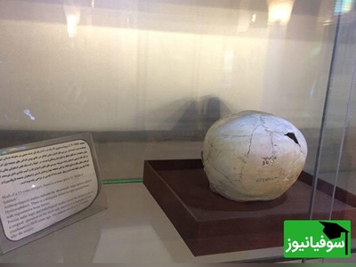 عکس /ایران پرچم‌دار اولین جراحی مغز تاریخ! / جراحی مغز 5000 ساله در ایران، کشف حیرت‌انگیز جمجمه‌ای که تاریخ پزشکی را بازنویسی می‌کند