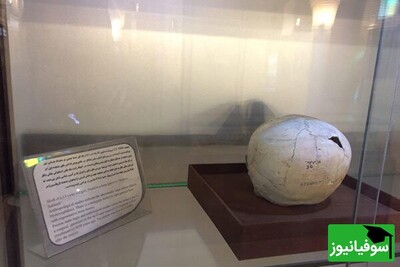 عکس /ایران پرچم‌دار اولین جراحی مغز تاریخ! / جراحی مغز 5000 ساله در ایران، کشف حیرت‌انگیز جمجمه‌ای که تاریخ پزشکی را بازنویسی می‌کند