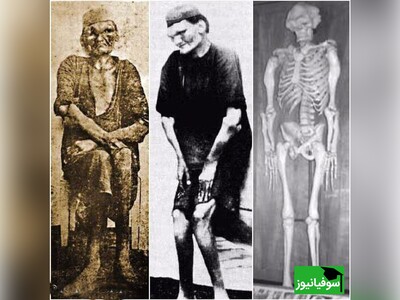 ویدیو/ "سیاه‌خان لپویی" عجیب‌‌الخلقه‌ترین مرد ایران که در 6 سالگی با جهش رشد ناگهانی به 20 سالگی رسید