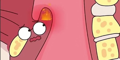 (ویدئو) اپی‌گلوتیت حاد چیست و چرا ممکن است بعد از یک لقمه داغ سراغتان بیاید؟