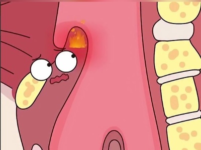 (ویدئو) اپی‌گلوتیت حاد چیست و چرا ممکن است بعد از یک لقمه داغ سراغتان بیاید؟