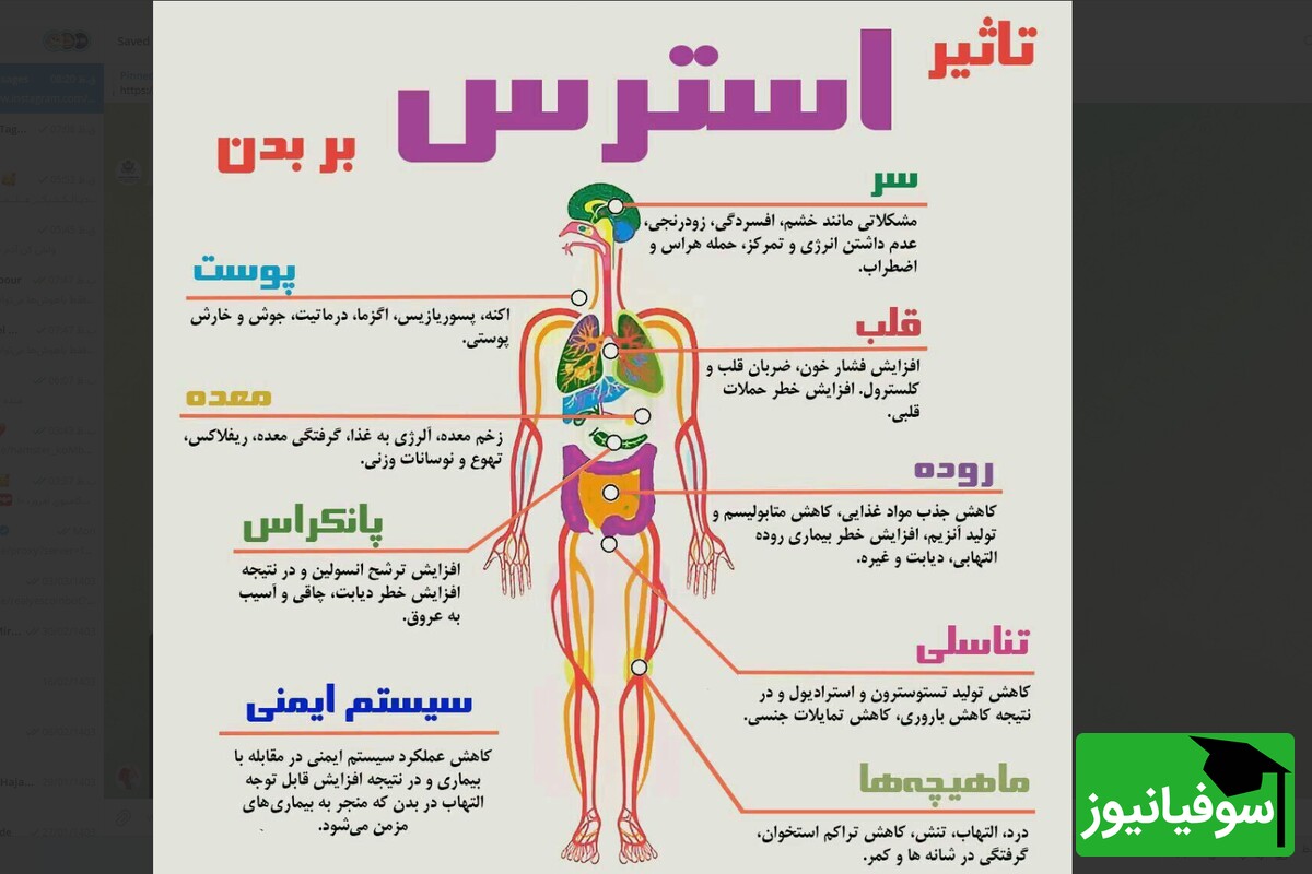 استرس