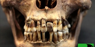 کشف راز جمجمه‌های 2 هزارساله با دندان‌های سیاه + عکس