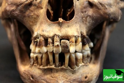 کشف راز جمجمه‌های 2 هزارساله با دندان‌های سیاه + عکس