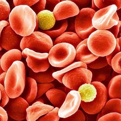 کشف نادرترین گروه خونی جهان؛ فقط چند نفر در کل زمین آن را دارند!