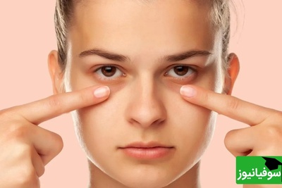 اگر از پف زیر چشم خسته شده‌اید، این راهکارهای ساده می‌توانند کمک‌کننده باشند