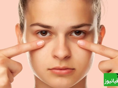 اگر از پف زیر چشم خسته شده‌اید، این راهکارهای ساده می‌توانند کمک‌کننده باشند