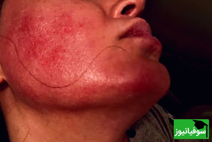 الناز شاکردوست