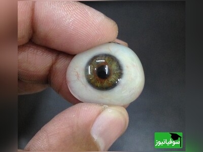 (ویدئو) 10 مورد از خطرات وحشتناک تأثیر استرس بر چشم