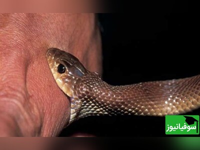 (ویدئو) توصیه‌های ایمنی برای جلوگیری از انتقال سم پس از گزیدگی
