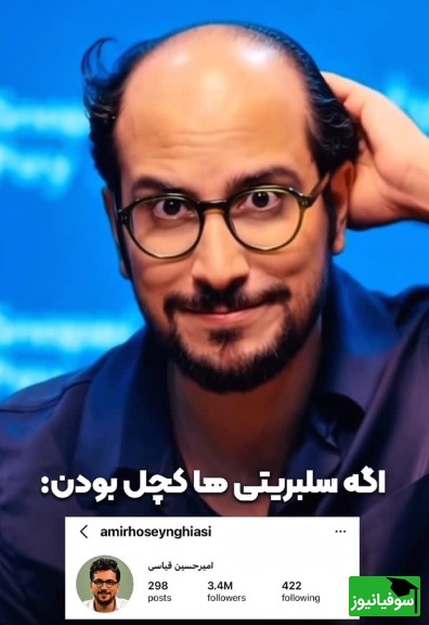 اگر سلبریتی ها کچل بودند چه ریخت و قیافه‌ای داشتن؟؛ فقط جواد خیابانی😂+ویدیو