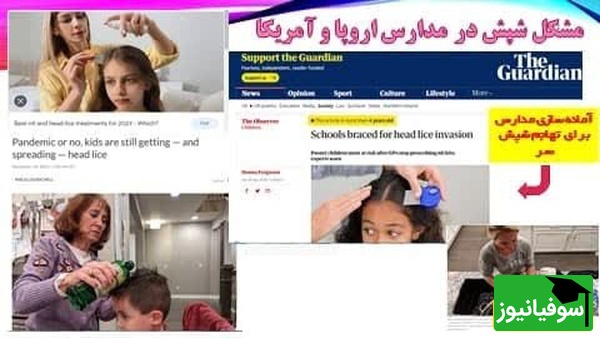 شپش