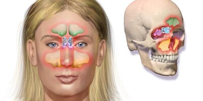 ویدیو / معجزه درمان سینوزیت؛ ترکیب شگفت‌انگیز نمک و عسل برای تنفس آزاد!