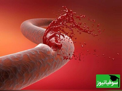 (ویدئو) خون‌ریزی بند نمی‌آید؟! توصیه‌های کارشناس هلال احمر را امتحان کنید