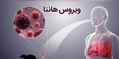 همه چیز درباره ویروس جدید هانتا؛ چقدر خطرناک است؟ + راه‌های انتقال و پیشگیری