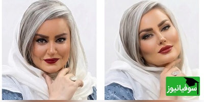 اگه بازیگران عمل زیبایی انجام میدادن چه شکل و شمایلی داشتند؟+ویدیو