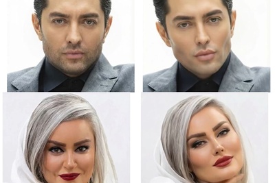 اگه بازیگران عمل زیبایی انجام میدادن چه شکل و شمایلی داشتند؟+ویدیو