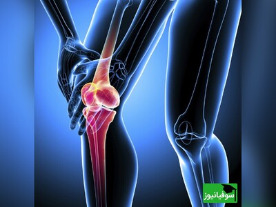 ویدیو/ شبیه‌سازی جالب نحوۀ عمل تعویض مفاصل یا آرتروپلاستی