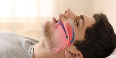 روش برای شکست دادن خروپف! اگر شوهرت نمی‌ذاره بخوابی، این ویدیو رو از دست نده