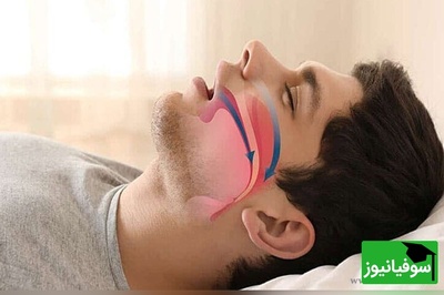 روش برای شکست دادن خروپف! اگر شوهرت نمی‌ذاره بخوابی، این ویدیو رو از دست نده