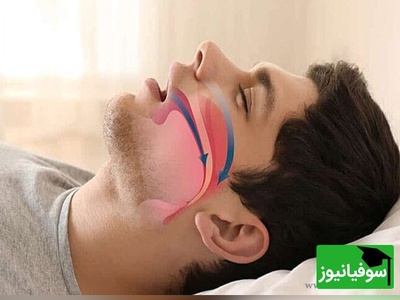 روش برای شکست دادن خروپف! اگر شوهرت نمی‌ذاره بخوابی، این ویدیو رو از دست نده