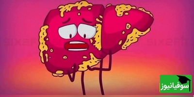 (ویدئو) وقتی قند با کبدت شوخی نداره! انیمیشن بامزه‌ای که حقیقت تلخ «کبد چرب» رو شیرین تعریف می‌کنه 🍭😅