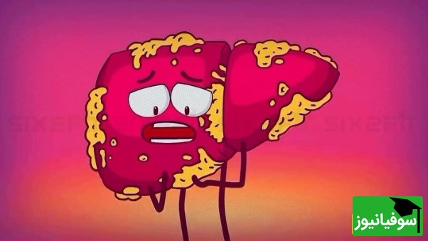 (ویدئو) وقتی قند با کبدت شوخی نداره! انیمیشن بامزه‌ای که حقیقت تلخ «کبد چرب» رو شیرین تعریف می‌کنه 🍭😅