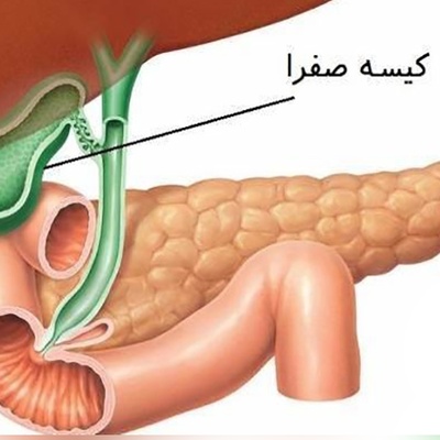 (ویدیو) دکتر علی‌اصغر زنده‌دل: با این میوه کبدتو مثل آب زلال پاک و پاکیزه کن! / توصیه‌های ناب طب سنتی در برنامه «صبحانه ایرانی»
