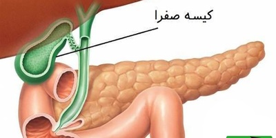 (ویدیو) دکتر علیاصغر زندهدل: با این میوه کبدتو مثل آب زلال پاک و پاکیزه کن! / توصیههای ناب طب سنتی در برنامه «صبحانه ایرانی»