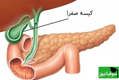 (ویدیو) دکتر علیاصغر زندهدل: با این میوه کبدتو مثل آب زلال پاک و پاکیزه کن! / توصیههای ناب طب سنتی در برنامه «صبحانه ایرانی»